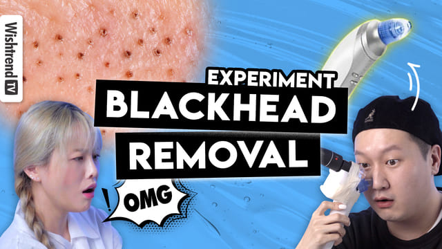 How to remove blackhead! Blackhead Removals Experiment
