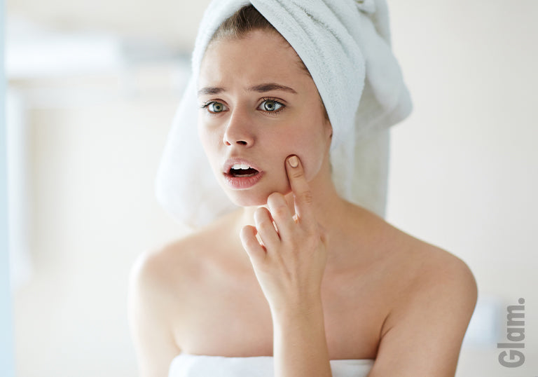 Acne Scars or Hyperpigmentation? Know the Difference!