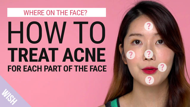 Acne 101 | Different Acne Meaning According to Different Parts of the Face