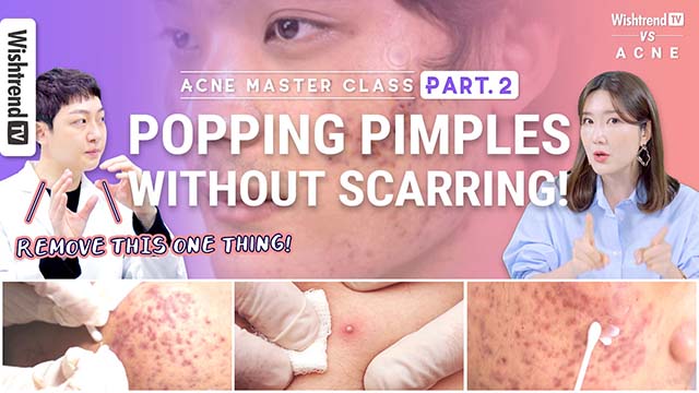 Acne Master Course Part. 2 | How to Extract Acne not leaving Acne Scars