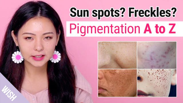 Freckles? Sun Spots? Pigmentation Meaning and How to Prevent & Fade Them