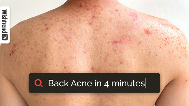 How to Get Rid of Back Acne - Bacne Treatment and Causes