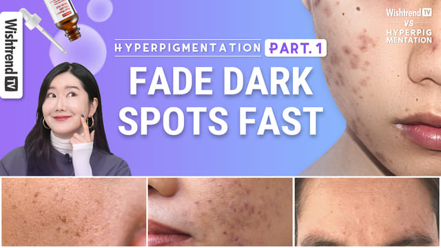 Fading Hyperpigmentation Fast Part.1 | Brightening Skincare Routine