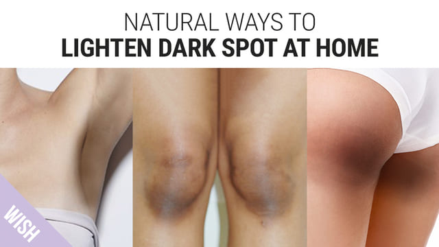 How to lighten dark Spots on Your Body! Skin Brightening Tips for Dark Spot