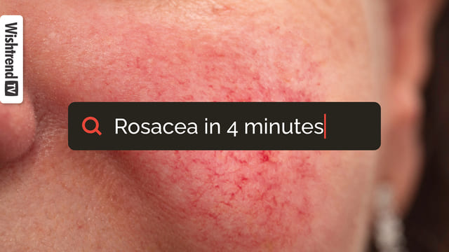 Rosacea 101: What is Rosacea? Main Cause? Treatment? | Tactics To Heal Rosacea