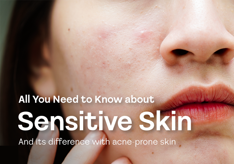 All You Need to Know About Sensitive Skin