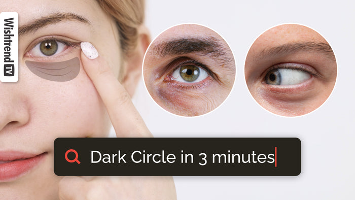 How To Get Rid Of Dark Circles | Treatment | Self-Care Tips