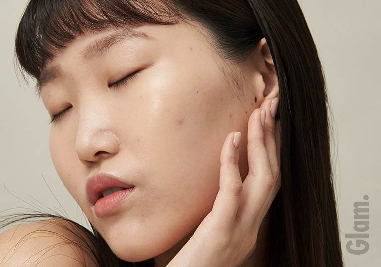Acne Myths You Need to Stop Believing From Today