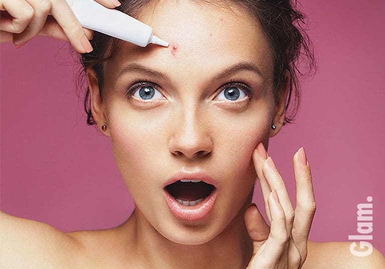 The Gentle Skincare For Acne You Need to Start Following Now