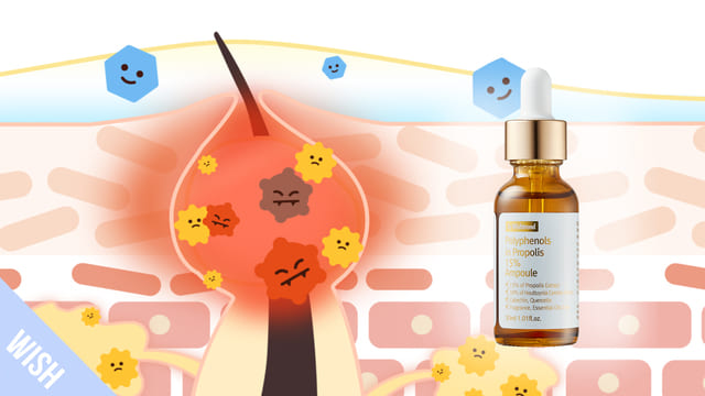 How does Polyphenols in Propolis 15% Ampoule Improve Acne-prone Skin type?
