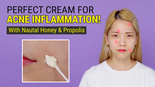 The Ultimate Moisturizer for Sensitive and Dry Acne Prone Skin | Honey Cream