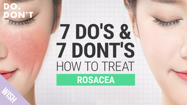 14 Tips for Rosacea That Really Work and Effective Skin Care Tips for Rosacea