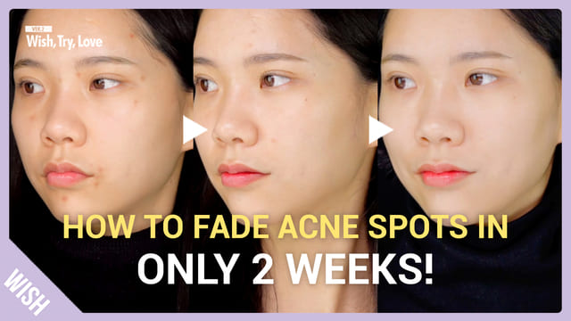 3 Secrets to Remove Acne Pigmentation & Brighten Skin Complexion Fast!