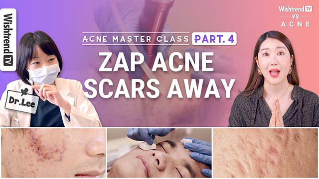 Acne Master Course Part. 4 | Acne Scar Treatment & Tips in Korea