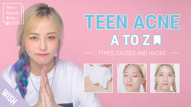 Acne Meaning & Acne Treatment for Teenage Girls and Boys