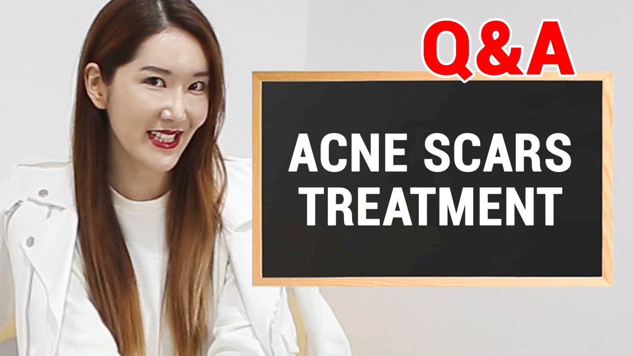 Acne Scars Treatment and Q&A