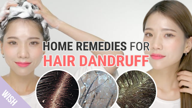 All about Hair Dandruff and Removal Tips