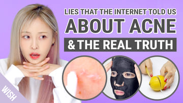 Biggest Acne Truth & Lies (5 Beauty Myths on Acne)
