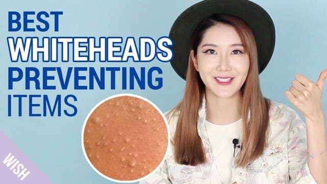 Causes of Whiteheads and How to Prevent Whiteheads