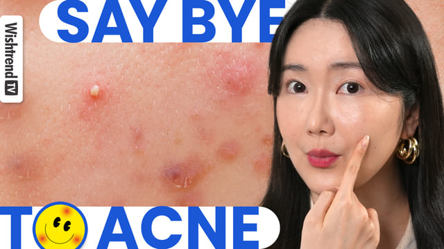 [Full] Have Acne Prone Skin? We had them, too! | Acne Self Care at Home