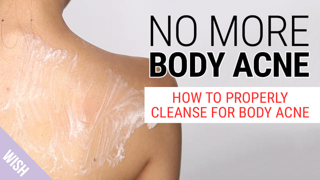 How Do We Get Rid of Body Acne? The Best Body Wash for Body Acne