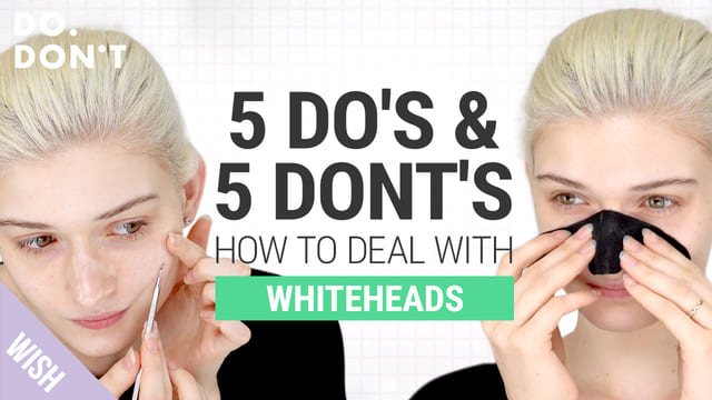 How To Effectively Get Rid of Whiteheads! 10 Tips for Whitehead Removal