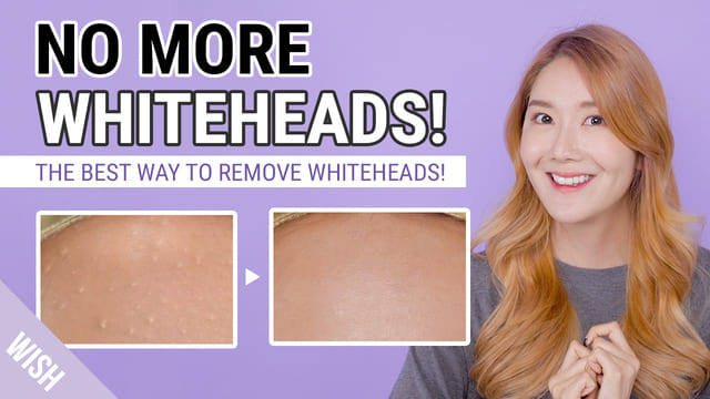 How To Remove Whiteheads, Small Bumps! Whitehead Removal for Prevention Care