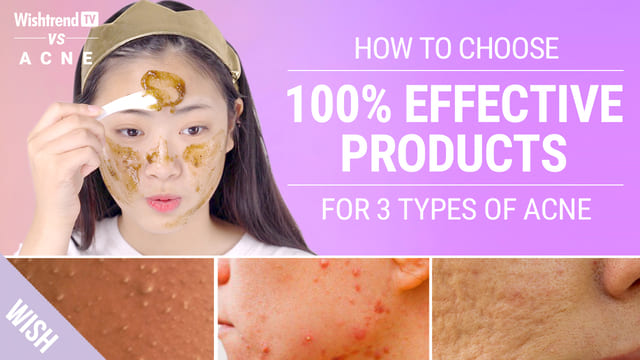 How to Choose Skincare That Really Works for 3 Different Types of Acne