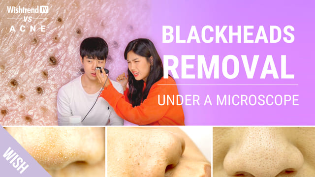 How to Remove Blackheads and NOT Enlarge Your Pores
