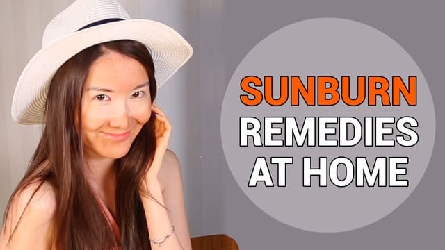 How to Treat Sunburnt Skin! Sunburn Remedies at Home