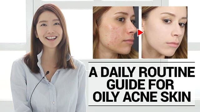 How to take care of Oily Acne Prone Skin, A Daily Routine Guide