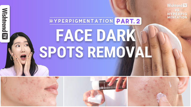 Fading Hyperpigmentation Fast Part.2 | Skin Brightening with AHA, BHA