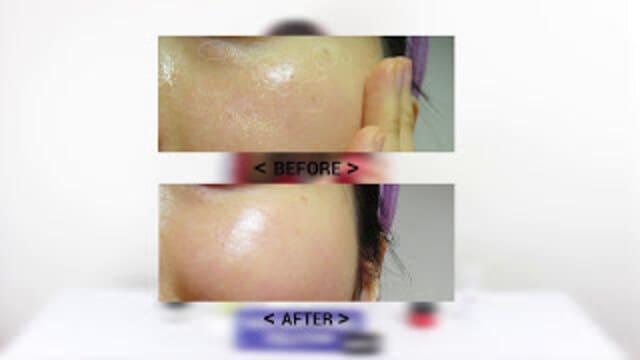Instant & Permanent Skin Brightening Solution