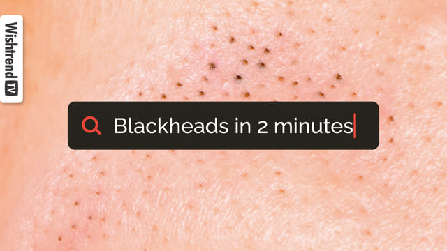 Is it bad to pop out blackheads? How to get rid of blackheads?