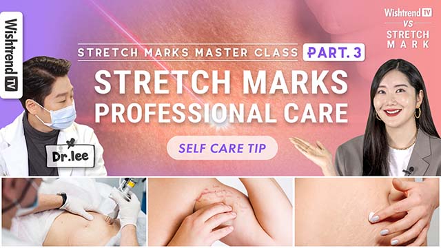 Stretch Mark Master Class PART. 3 | All About Stretch Marks and Self Care Tips