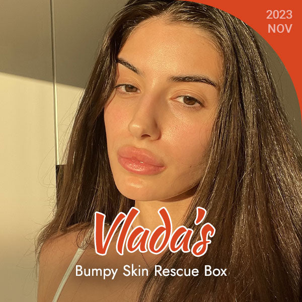 Vlada's Bumpy Skin Rescue Box